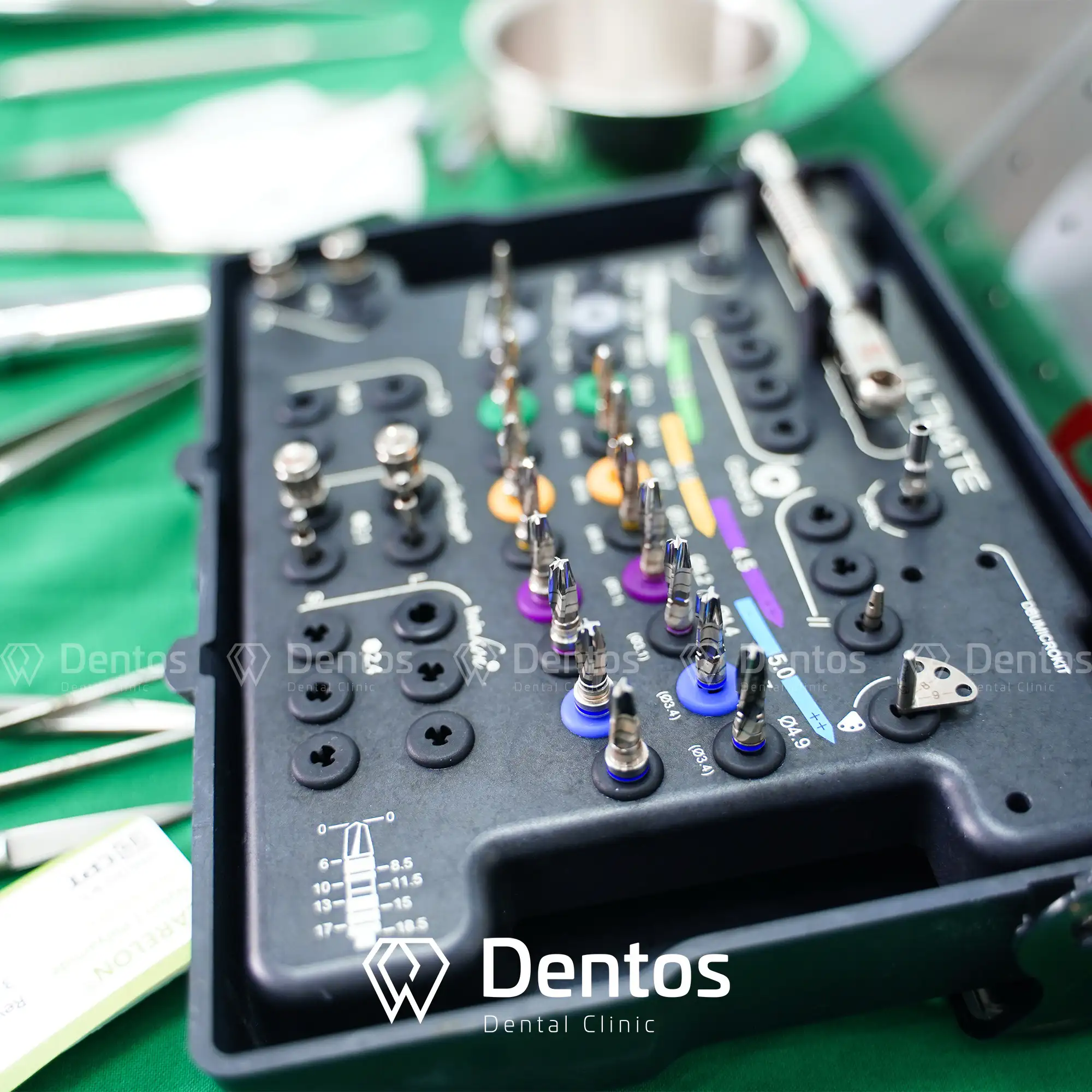 Các dòng trụ implant cao cấp của Pháp đều được chế tác từ vật liệu Titanium tinh khiết